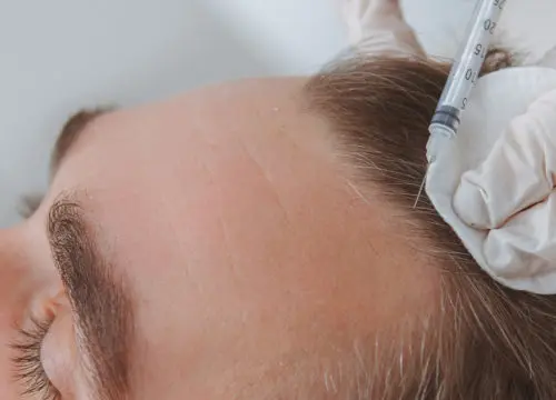 Man receiving CIT hair treatments