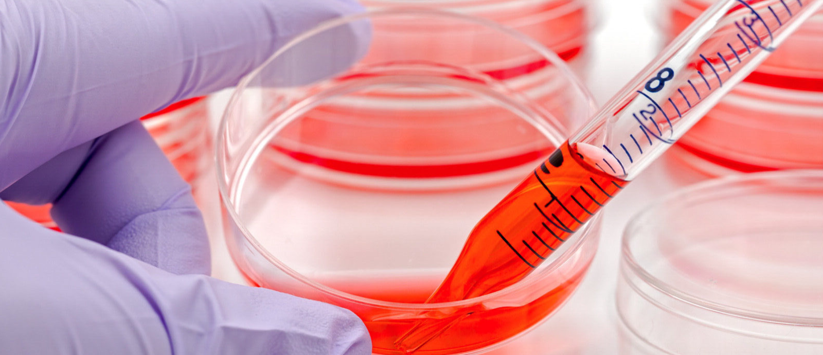 Stem Cell Therapy