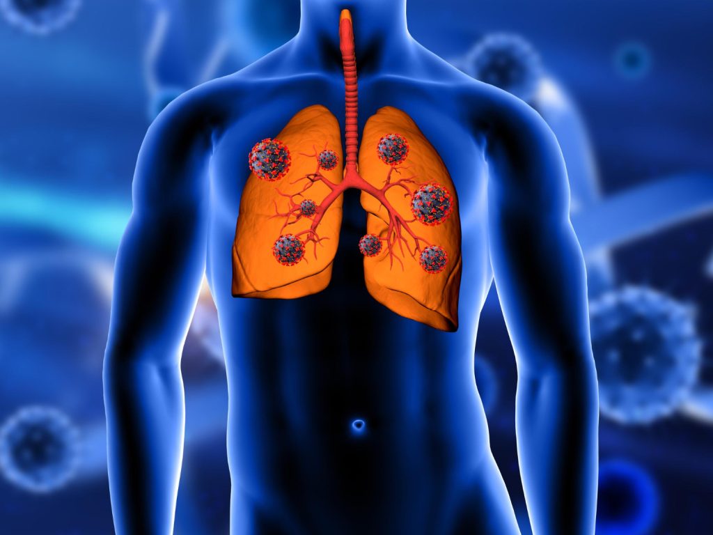 Inflammatory Lung Conditions