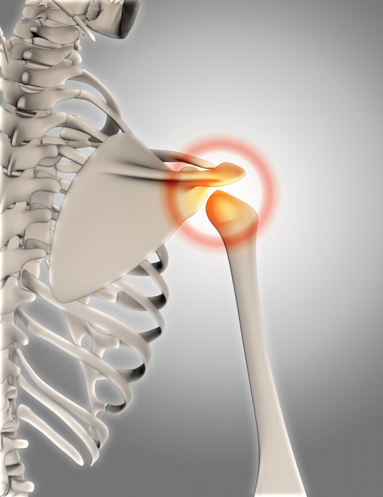 Shoulder & Rotator Cuff Injuries