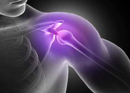 Shoulder and rotator cuff injuries