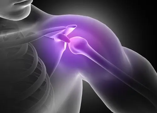 Shoulder and rotator cuff injuries
