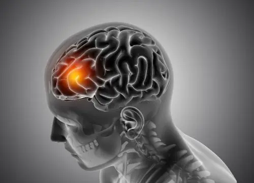 Traumatic Brain Injury