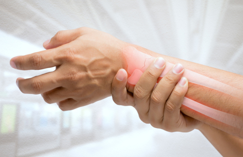 Bone Fractures and Bone Healing