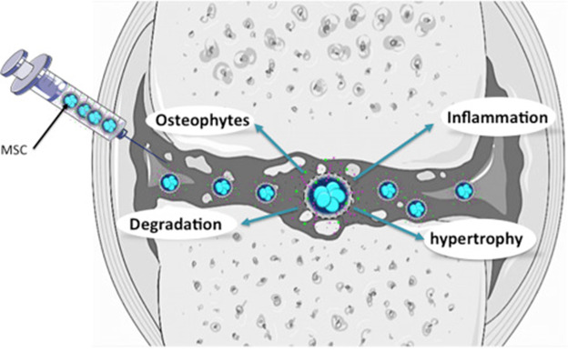 Osteoarthritis2-1