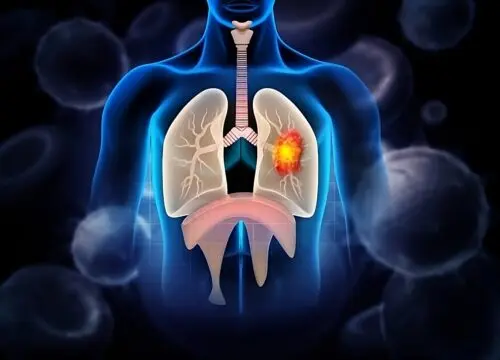 lung disease