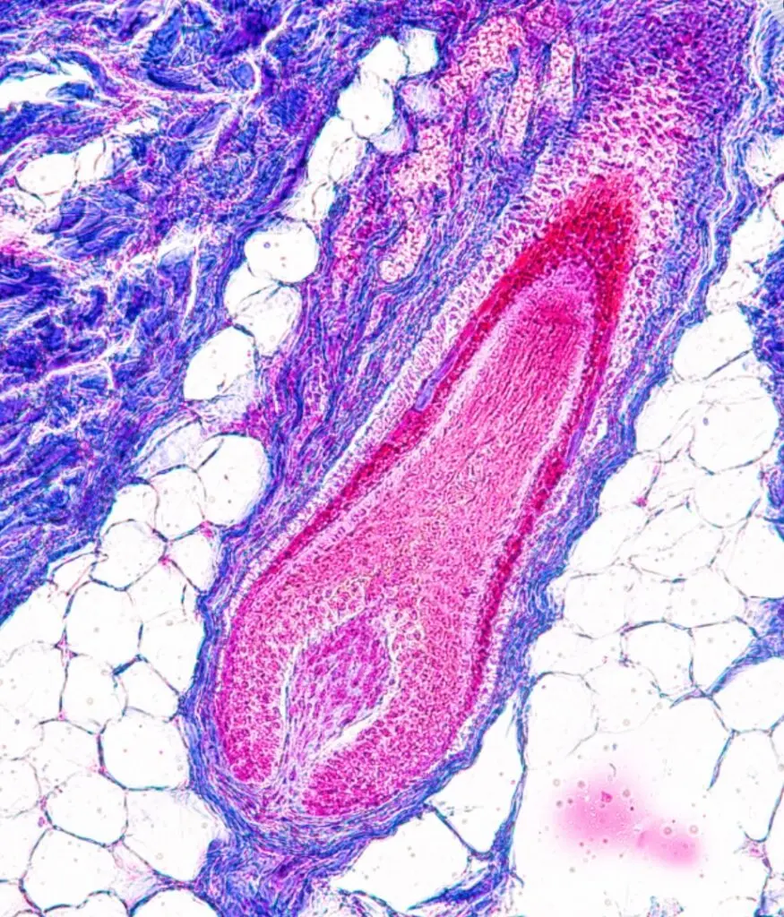 Common Types of Hair Loss