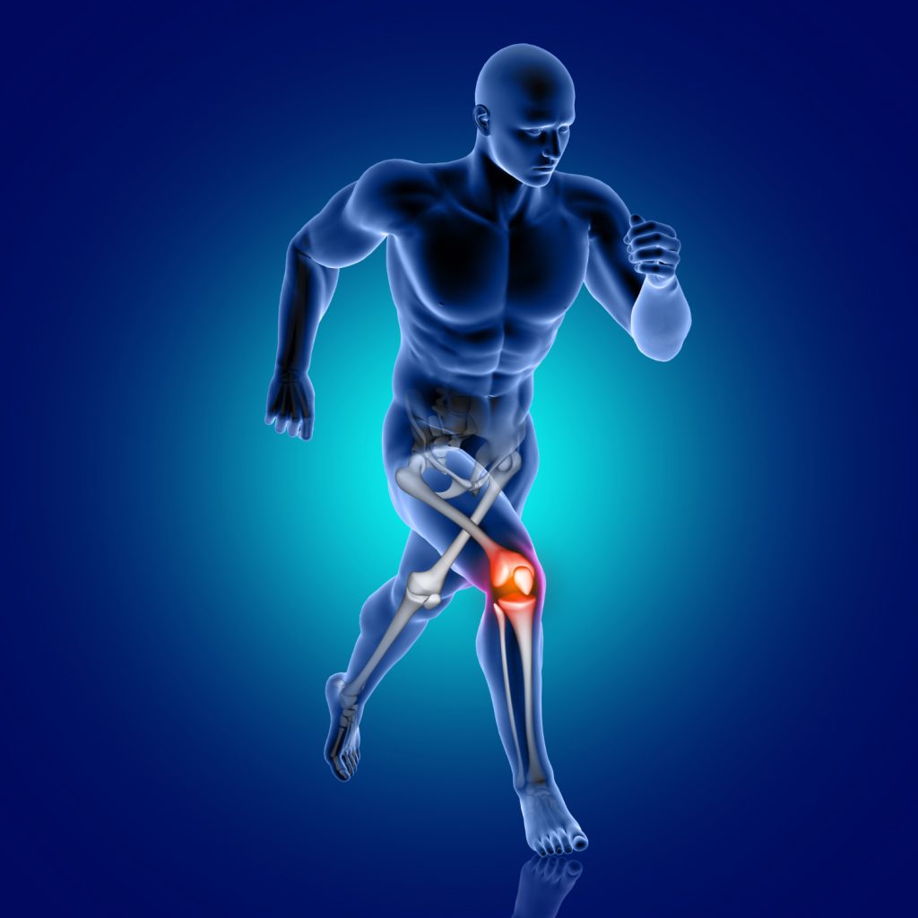 Umbilical Stem Cells for Knee Pain